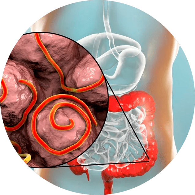 Przewód pokarmowy i pasożyty
